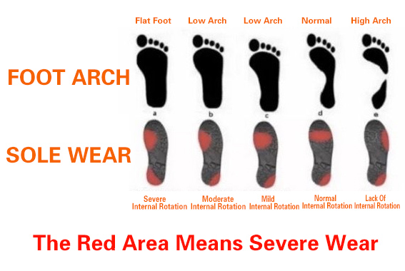 Foot Type For Running Shoes 